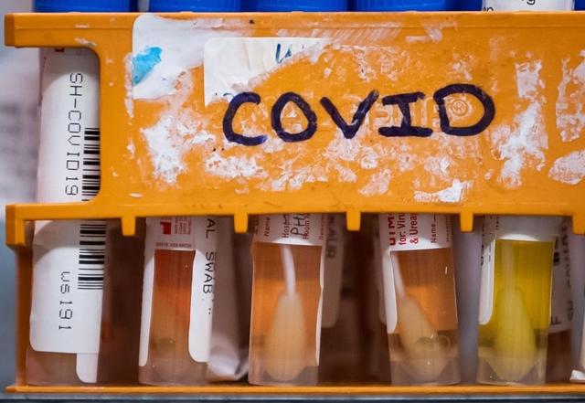 60 cases of COVID-19 linked to the Big White Ski Resort reported in Kelowna - https://cdn.connectfm.ca/1C032A46-42D6-4249-A548-FB7699730C52_Story955944_1382580.jpg