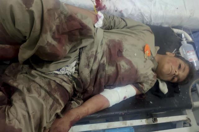 Atleast 50 dead & over 90 injured in Pakistan bomb blasts - https://cdn.connectfm.ca/4CBB22CC-38F9-4CA8-A6E5-162AE89CBD93_Story2590416_3440630.jpg