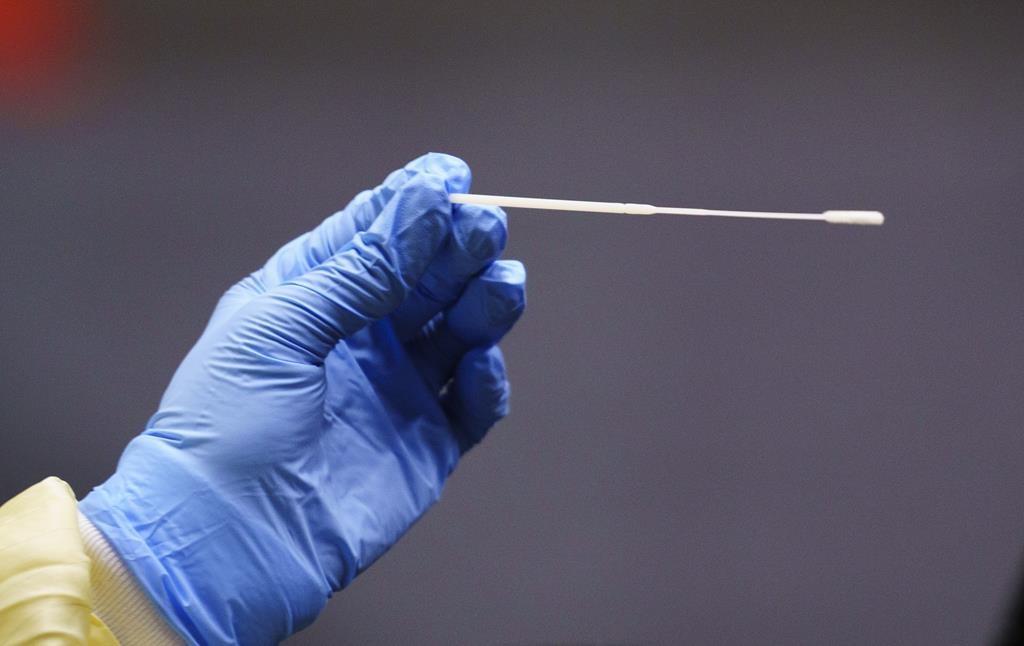 canada-maintained-an-average-of-7-672-daily-cases-of-covid-19-during-first-week-of-january