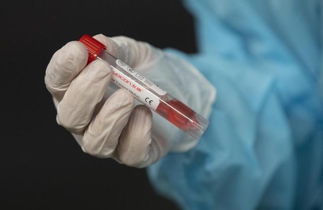 Outbreak of COVID-19 at two lodges where people working on the Coastal GasLink pipeline project have been staying - https://cdn.connectfm.ca/8B8FD0EF-F0AC-4978-86F5-9BD832A27AE6_Story963254_1393631.jpg