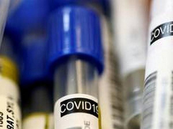 India's coronavirus tally increasing rapidly - https://cdn.connectfm.ca/B4B2EDE0-385E-45FB-8AAF-739DD7488E2B_Story617329_894772.jpg