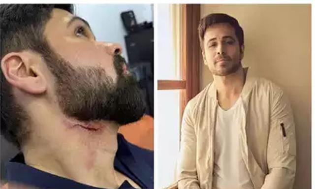 Emraan Hashmi injured - https://cdn.connectfm.ca/Emraan-Hashmi.jpg