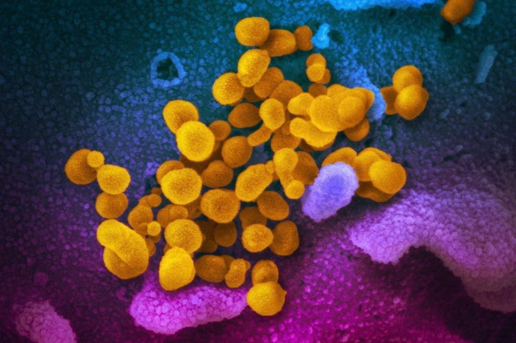 pandemic-towards-its-peak-in-ontario-and-quebec