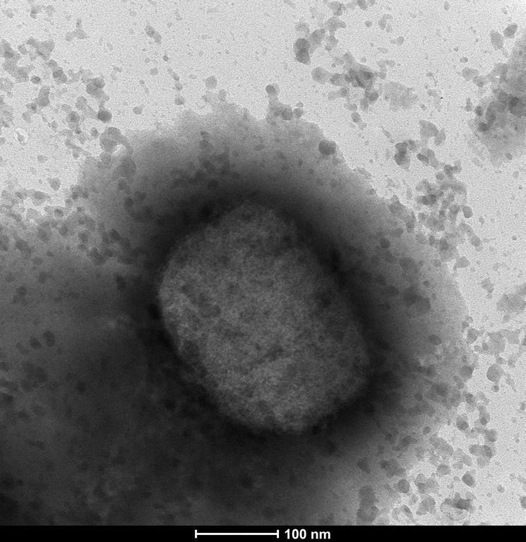 168-cases-of-monkeypox-confirmed-in-canada-including-141-in-quebec